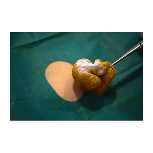 NOBA VERBANDMITTEL DANZ Nobadrape Lochtuch 45x75cm PK 40 sk, steril, 2lg.