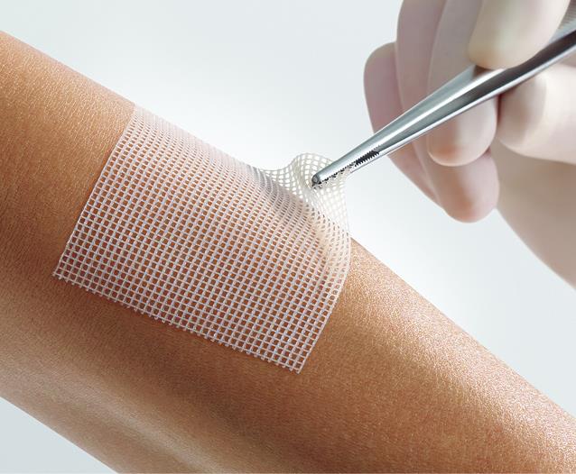 Lomatuell Pro gelbildendes Kontaktnetz , steril, 10x40cm, 10 Stück