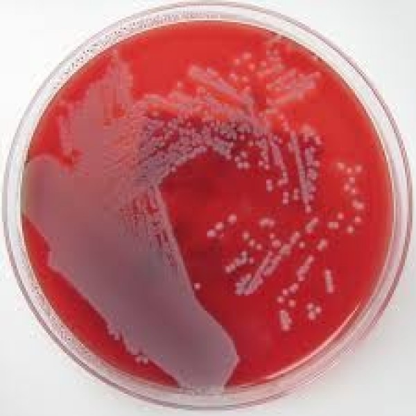 MacConkey II Agar AP 20 Nachweis Enterobacteriaceae