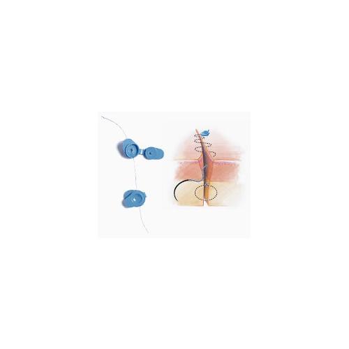 Absolok Clipapplikatoren 18,5cm resterilisierbar f. kleine Clips