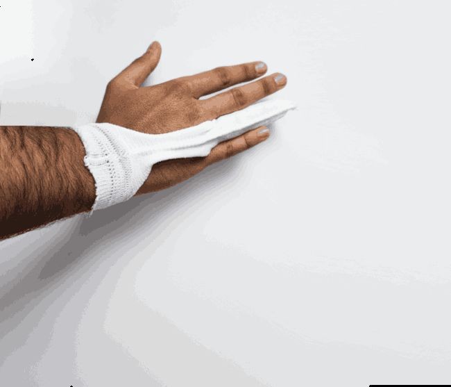 Carefix Finger-u. Zehenverband groß PK 20 braun