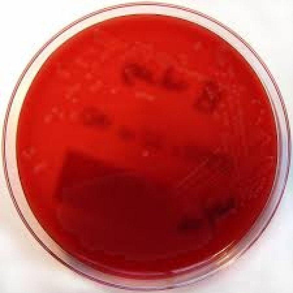 Columbia-Agar mit 5% Schafblut AP 20 Nachweis d. Hämolysereaktion