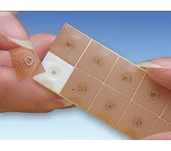 MEGRO Ratiomed Akupunktur Ohr-Dauernadel AP 100 0,22x1,50 - Bild 2