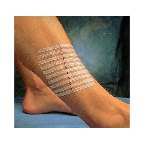 Steri-Strip 25,0 x 127,0 mm AP 25 Umschläge á 4 Streifen