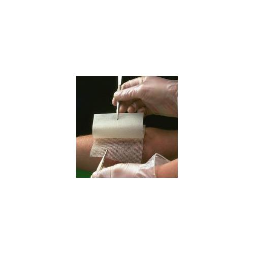 Smith & Nephew Medical Ltd Bactigras 10cmx10cm antiseptischer AP 10 Paraffingazeverb., steril