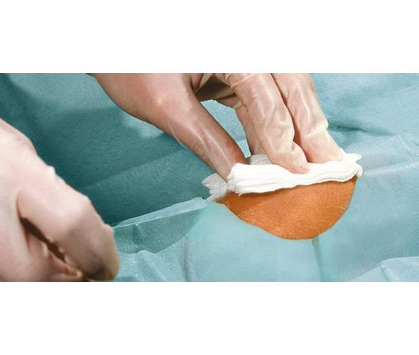 Paul Hartmann AG Foliodrape Protect Lochtuch AP 25 150x120cm, Ø 7cm, sk