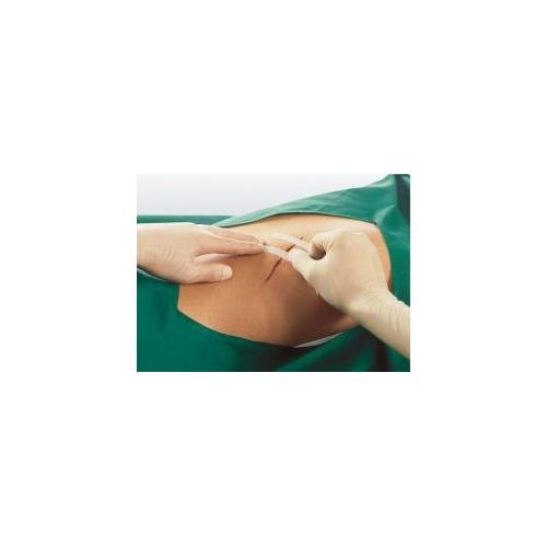 Smith & Nephew Medical Ltd Leukostrip 76mm x 6,4mm AP 10 à 3 Wundnahtstreifen