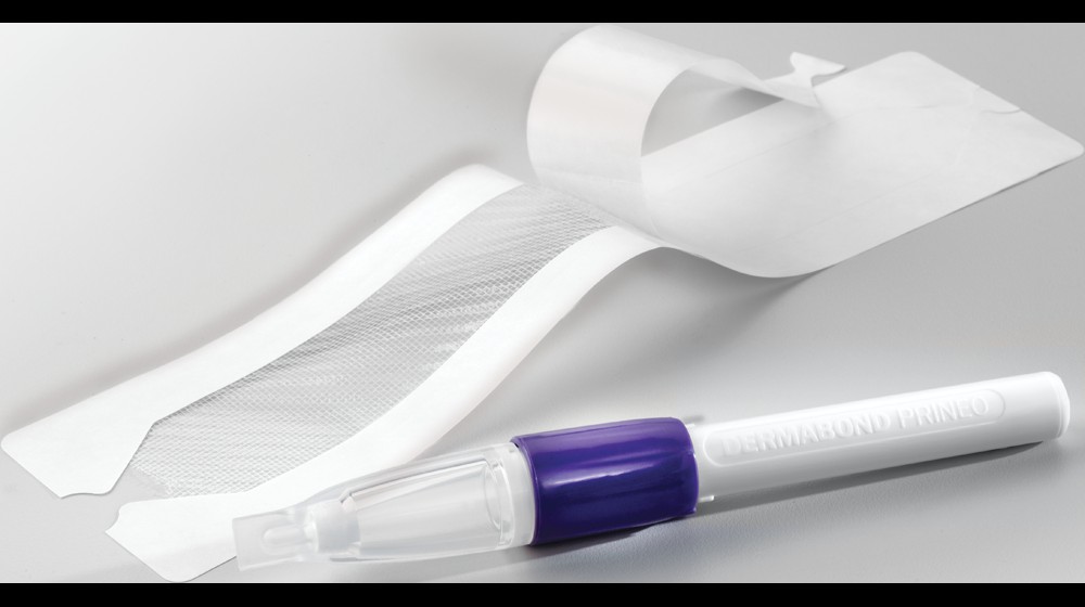 Dermabond Prineo PK 2 Wundverschluss