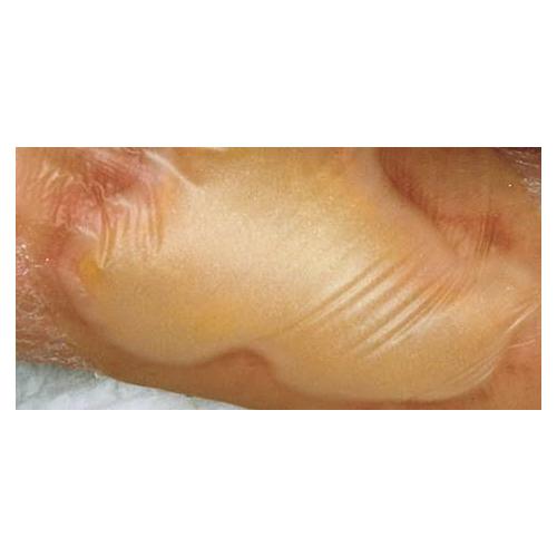 Paul Hartmann AG Hydrocoll Classic thin 10 x 10cm AP 10 Hydrokolloid-Verband - Bild 2