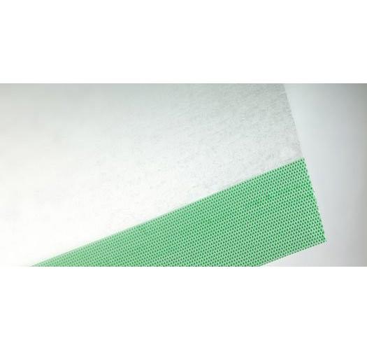 Opsite Inzisionsfolie 10cmx14cm AP 50 transparente PU-Folie, steril