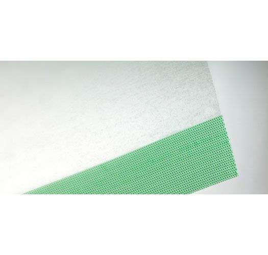 Smith & Nephew Medical Ltd Opsite Inzisionsfolie 10cmx14cm AP 50 transparente PU-Folie, steril